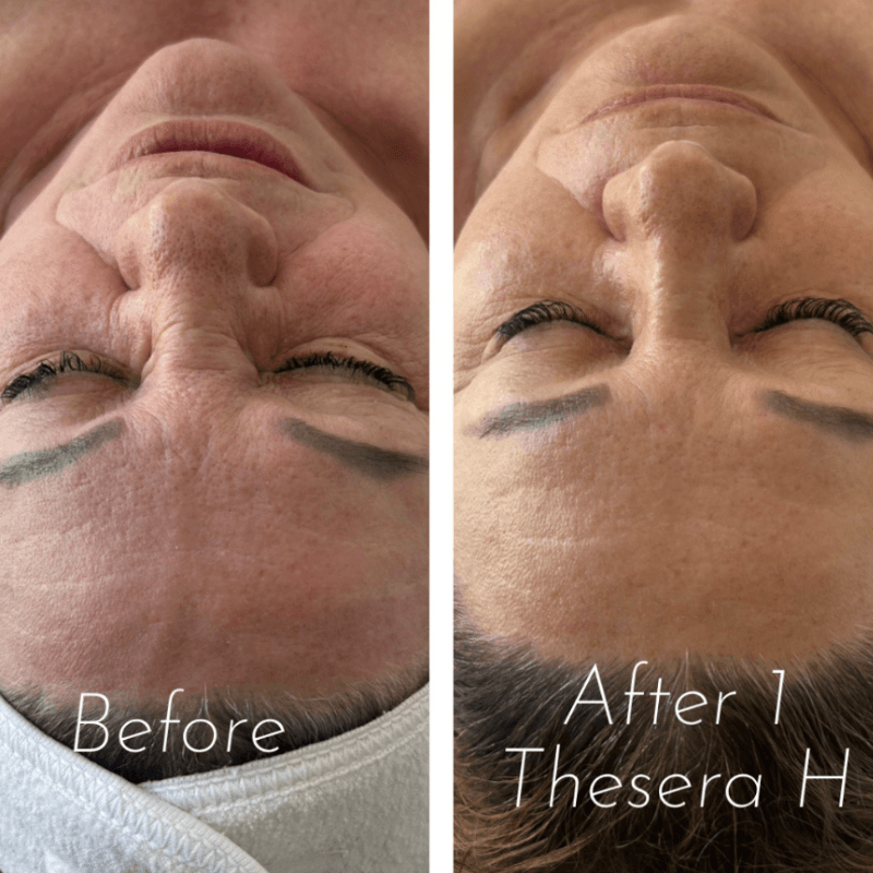 Before and after: Hydration & Glow